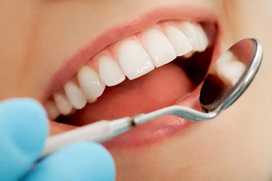 Diş Eti Tedavisi (Periodontoloji)